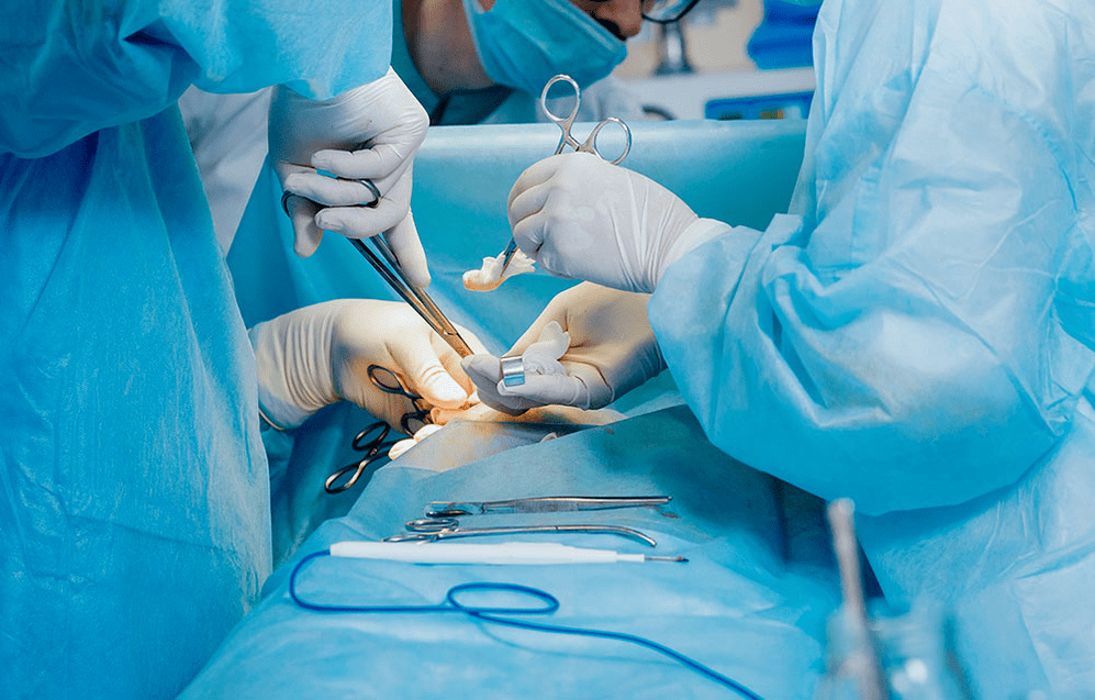 χειρουργική μέθοδος μεγέθυνσης πέους
